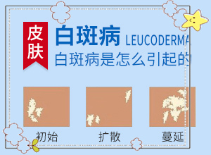 白癩病的圖片,白斑病情有哪些癥狀(會(huì)有什癥狀)