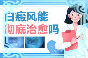 長白癩風(fēng)有什么癥狀,如何正確區(qū)分(癥狀歸納總結(jié))