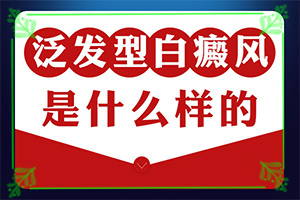 白癩風(fēng)有哪些的癥狀[發(fā)病的時(shí)候有什么癥狀]輕微白癩風(fēng)圖片
