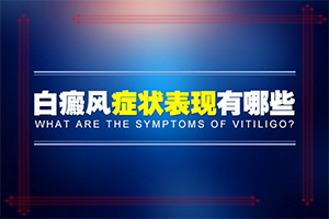 白癲瘋要如何治療[怎么治才能快點(diǎn)好]專(zhuān)業(yè)治療臉上白癜風(fēng)醫(yī)院