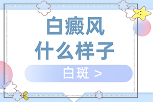 重度白癩風(fēng)圖片[主要癥狀什么樣]怎樣判斷是不是白癩風(fēng)