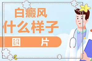 白癩風(fēng)的圖片早期,初期癥狀有哪些(得了會有什么特征)