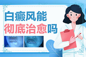 白點(diǎn)癲風(fēng)的圖片[容易被忽視癥狀有哪些]白癲風(fēng)的癥狀是什么