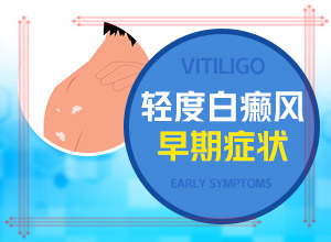 白癩風(fēng)初期什么樣子,主要癥狀什么樣(常見(jiàn)癥狀有什么特點(diǎn))