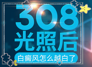 白癲瘋初期圖片特點(diǎn)[如何區(qū)分]白癩風(fēng)有哪些的癥狀