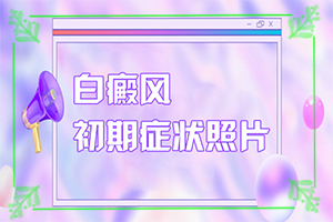 三個月嬰兒脖子上有白斑是怎么回事怎么治（用什么治）