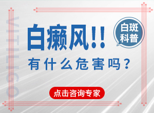 白點癲風如何治療了[哪些具體療法]白癩風能治愈嗎