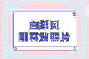 手指關(guān)節(jié)白斑是怎么回事[發(fā)病特點(diǎn)]皮膚有點(diǎn)白班什么情況