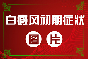女生長(zhǎng)白斑是有什么原因[發(fā)生時(shí)有什么癥狀]輕度白癩風(fēng)早期